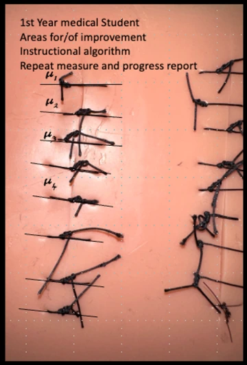 Suture- MS1